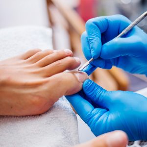 Curso de Pedicure Medical e Remoção de Fungos a Laser